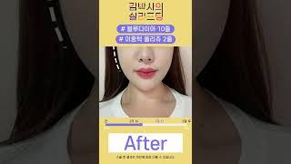 #shorts 실리프팅 효과 살펴보기! 피부 처짐 문제는 이것으로 해결!