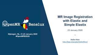 MR Image Registration with Elastix and Simple Elastix