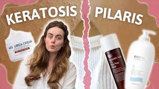 Goodbye Strawberry Legs & Keratosis Pilaris aka. Chicken Skin: Tips That Work! 