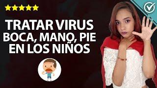 Cuanto Dura y Como Tratar el Virus Boca, Mano, Pie en los Niños 