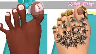 Dokter Kaki Bebas Bulu Foot Clinic  | Game Wilson Kiddy