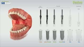 Dentium NR Line