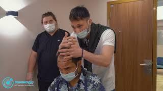 6 Patients on BlueMagic Group - Hair Transplant Professionals