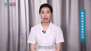 【眼科】眼睛过敏红肿痒怎么办