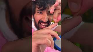 The Hangnail Chronicles: A Comedy of Errors 