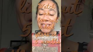 Full vid on channel! #chronicpain #motivational #series #mentalhealth #indie #film #arcticmonkeys