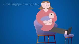 Nottingham University Hospitals NHS Trust Maternity Discharge Video - full video