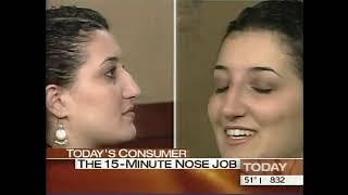 Dr. Alexander Rivkin | Today Show  | Los Angelese Non Surgical Nose Job | Westside Aesthetics
