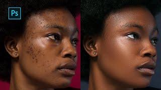 High-End skin Retouching Photoshop Tutorial | Frequency Separation