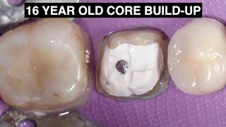 Core Build-Up Masterclass