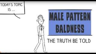 Male Pattern Baldness - Truth Be Told