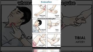How to check pulse #health #doctor