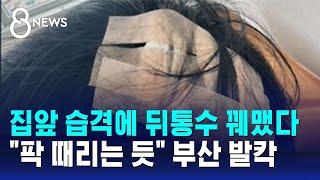 집앞 습격에 뒤통수 꿰맸다…"팍 때리는 듯" 부산 발칵 / SBS 8뉴스