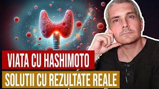 Viata fara HASHIMOTO - Solutii care chiar functioneaza