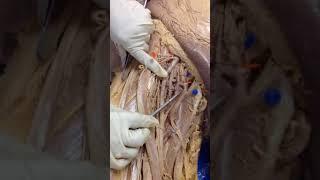 Femoral Artery and Branches dissection of cadaver- human anatomy lab- 1st MBBS