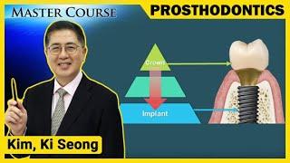 [Master Course Season2 -PROSTHODONTICS] Top-down Treatment