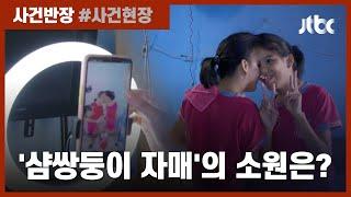 SNS 데뷔한 13살 샴쌍둥이 자매 "유명해져서 분리수술 할래요" / JTBC 사건반장