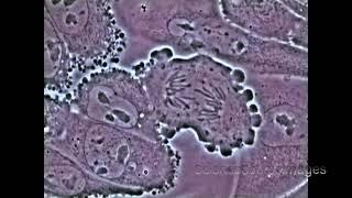 Mitosis in an animal cell Under the Microscope