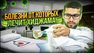 Болезни  и недуги от  которых эффективно лечить Хиджама.