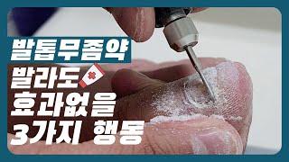 무좀약 이렇게 안바르면 효과없어요! 올바른 발톱무좀 관리방법