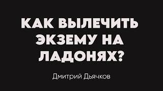 Как вылечить экзему на ладонях? Психосоматика экземы. Разбор случая клиента