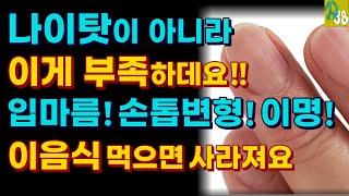 입마름, 혀통증, 손톱변형이 있다면 반드시 확인해보세요! 이것 결핍일 수 있습니다. 계단 오를 때 숨가쁨, 귀에서 소리나는 이명도 이런 음식 충분히 드세요!!