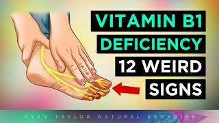 12 Strange Signs Your Body NEEDS Vitamin B1