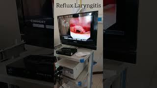 Reflux Laryngitis