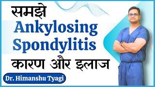 समझे Ankylosing Spondylitis कारण और इलाज | What is ankylosing spondylitis ?