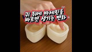 바세린을 귀 뒤에 바르면 생기는 놀라운 변화 #건강 #바세린 #건강정보
