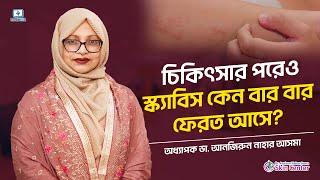 ট্রিট্মেন্টের পরেও স্ক্যাবিস কেন ফিরে আসে #scabis