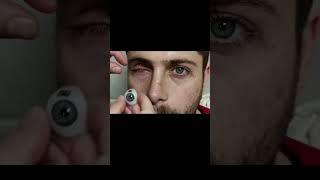custom eye silicone prosthetics #CustomProsthetics #SiliconeProsthetics #Prosthetic #MedicalSilicone