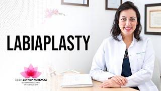 Labiaplasty