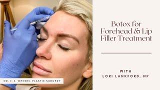 Botox for Forehead & Lip Filler Treatment | Dr. J. J. Wendel Plastic Surgery | Nashville