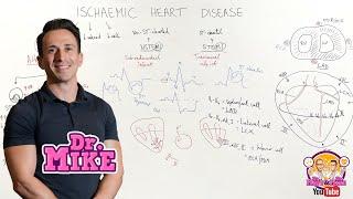 Ischemic Heart Disease (Coronary Artery Disease)