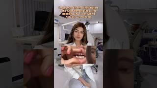 These Influencers are not Posting Veneers on their social media! | Dr. Glam #drglam #veneers