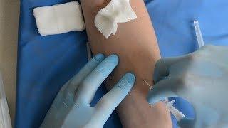 Катетеризация периферической вены / peripheral venous cannulation