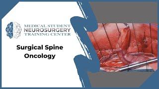 Surgical Spine Oncology