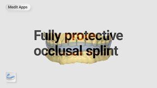 Designing a Fully Protective Occlusal Splint with the Splints App