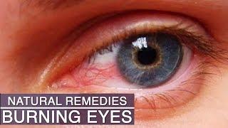 Eye Strain & Burning Eyes Home Remedies | 5 Natural Remedies for Eye Strain, Tired and Burning Eyes|