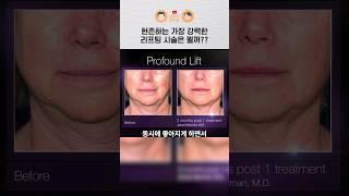 리프팅 끝판왕 프로파운드는 어떤 시술일까?