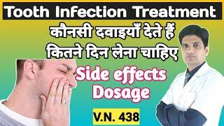 Tooth infection treatment | Dental infection treatment | dental infection medicine