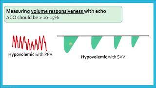 Assessing Cardiac Output and Volume Responsiveness - Critical Care Echo