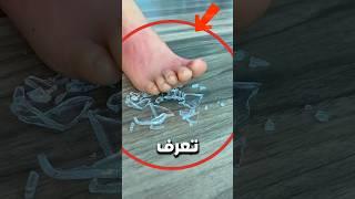 كيف تتصرف إذا دخلت قطعة زجاج في قدمك  ؟!  #شورتس #اكسبلور