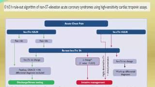 NSTACS ESC guidelines