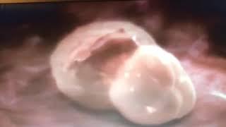 Как происходит имплантация эмбриона