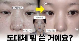 피부과 안 가도됨‍️ '홈케어' 만으로 10분만에 요철+피지 박멸하는 법  (+관리 후 꿀템까지 !) | 소윤Soyoon