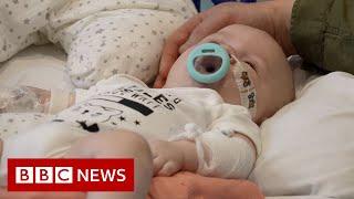 World's most expensive medicine treats infants with genetic disorder - BBC News