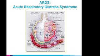 Overview of Critical Care Management of COVID Patients in the ICU by Dr. Bassily-Marcus, MD