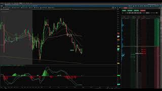 How to set a stop loss and limit sell simultaneously in Think or Swim